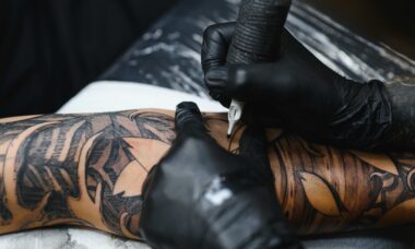 Tattooentfernung Dortmund